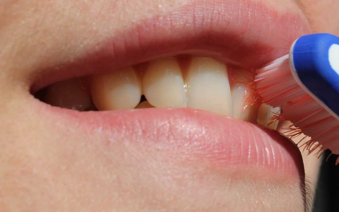 Tips for Protecting Your Teeth and Gums