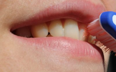 Tips for Protecting Your Teeth and Gums